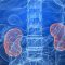 ¿Qué es la encefalopatía renal?